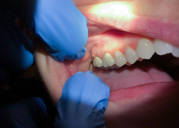 Best Knocked-Out Tooth Emergency  in West Point, UT